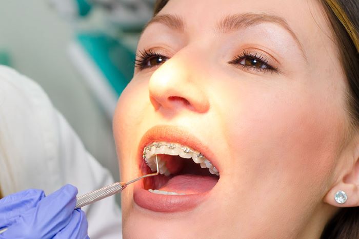Visit Dentist During Ortho Treatment